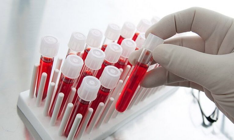 blood in test tubes for analysis of dogs with prostatitis